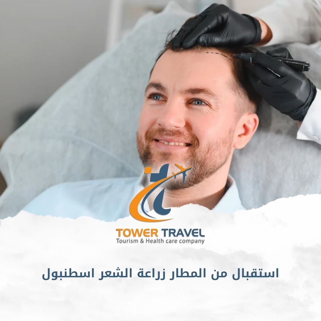 استقبال من المطار زراعة الشعر اسطنبول