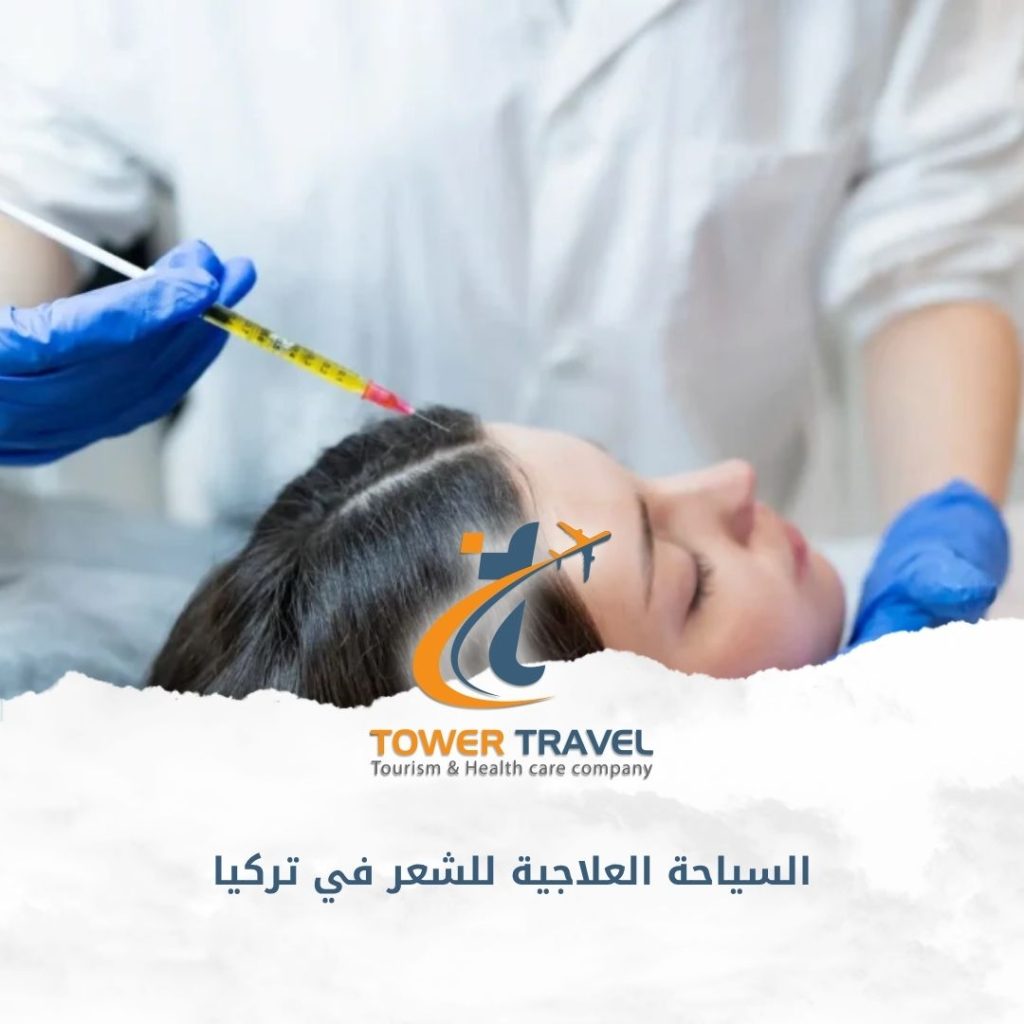 السياحة العلاجية للشعر في تركيا