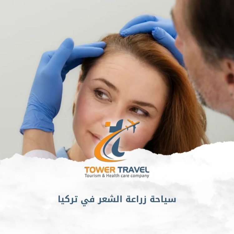 سياحة زراعة الشعر في تركيا