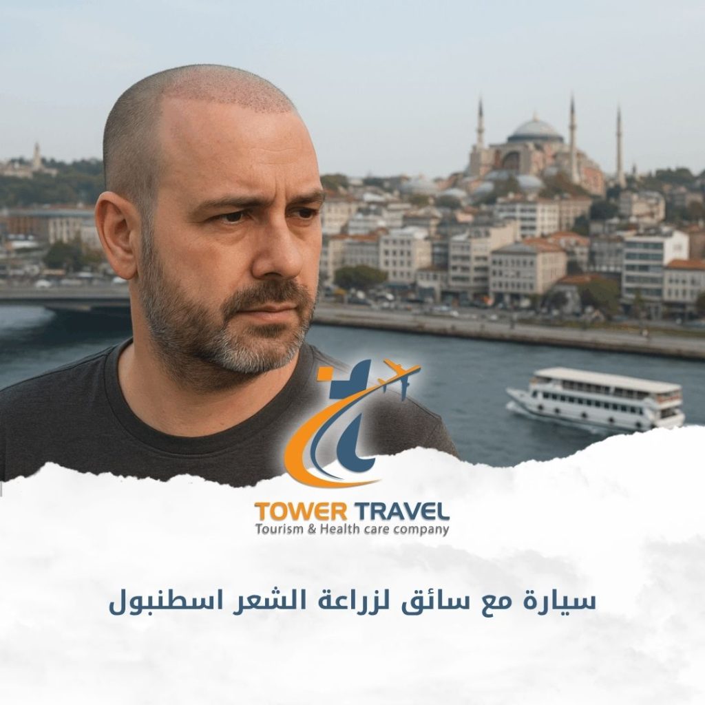 سيارة مع سائق لزراعة الشعر اسطنبول