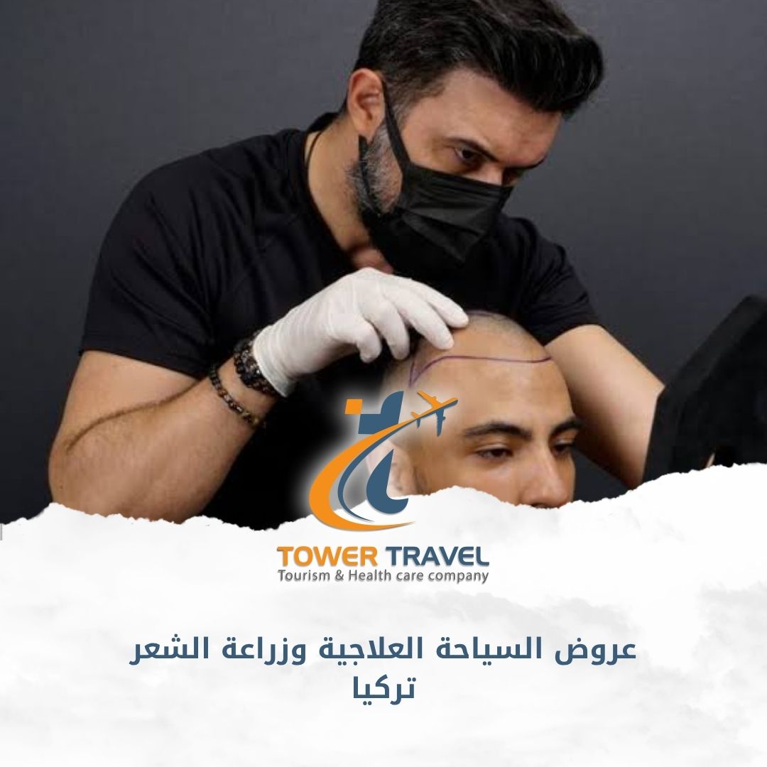 عروض السياحة العلاجية وزراعة الشعر تركيا